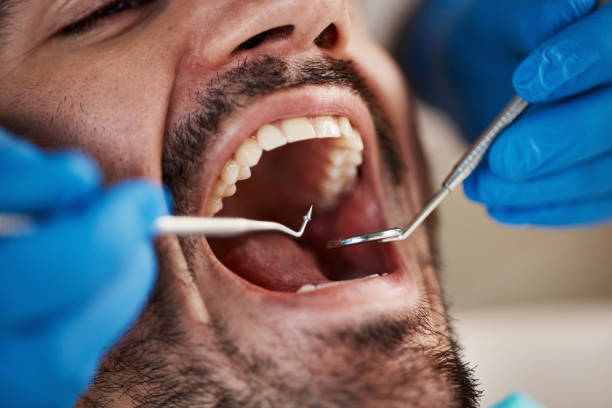 Best Emergency Treatment for Oral Infections in Onancock, VA